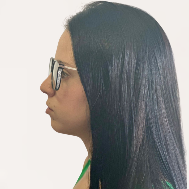 Crystal Elite Vision – Gafas multifocales con regalos gratis