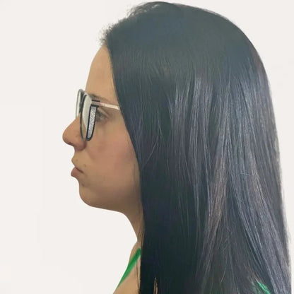 Oferta exclusiva 2 por 1 – Gafas Crystal Elite Vision